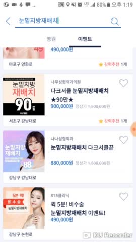  성형이벤트 리뷰 / 눈밑지방재배치 가성비 좋은 이벤트