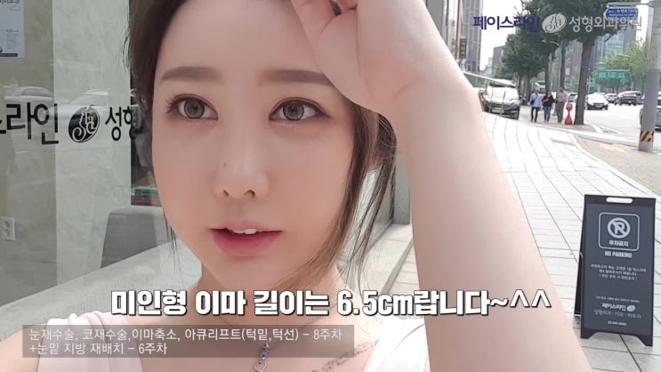  BJ여순의 스마트 이마축소술후기