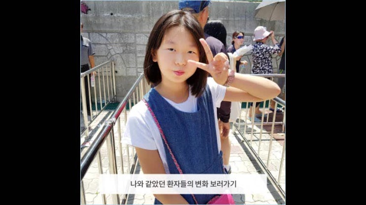  지루피부염증상 대화할 때도 눈치를 봤어요