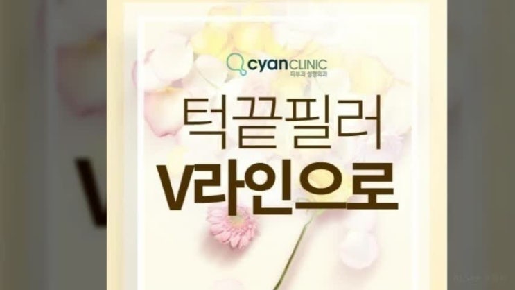  턱필러후기 자연스럽게.