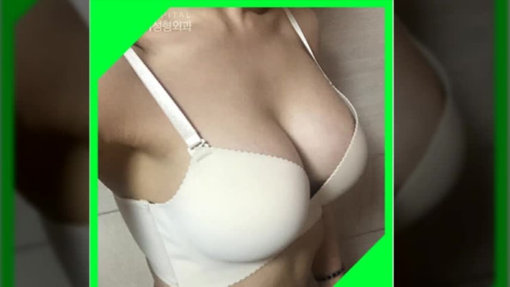  가슴성형비용 따져봐도 당연히 아이디!
