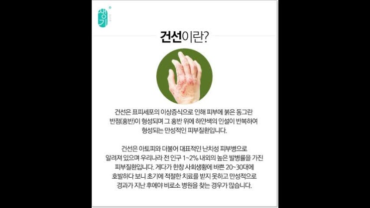  분당건선 나아지고 싶다면