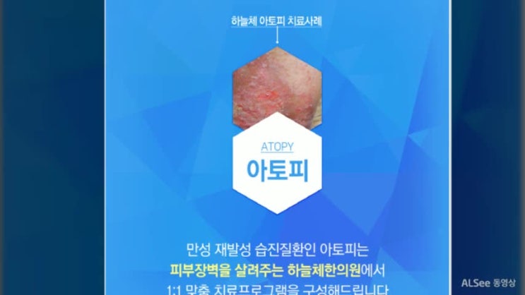 부산아토피 견뎌내고 있나요