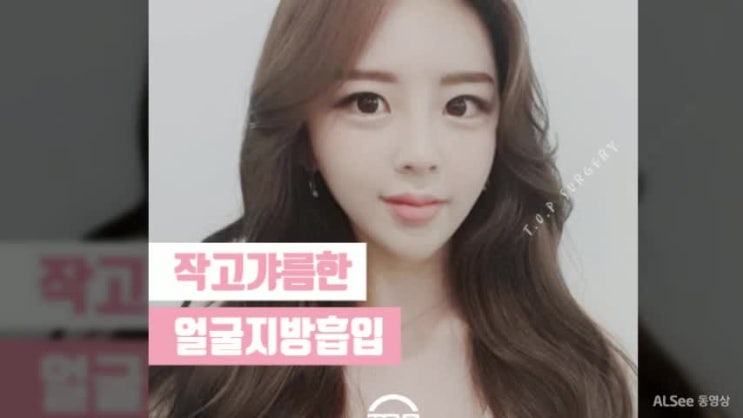  얼굴지방흡입 섬세하게 아름다운 라인으로! 