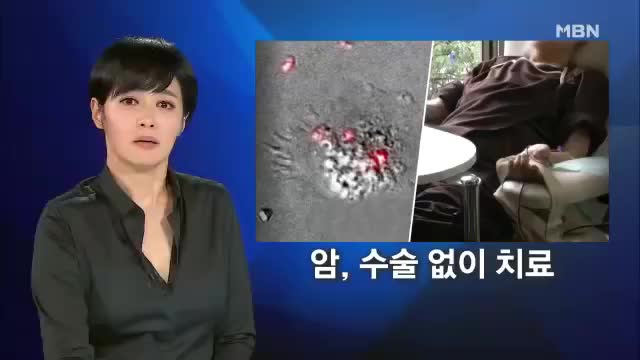  mbn의 면역세포 뉴스