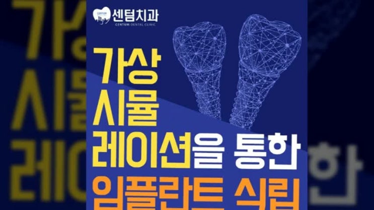  임플란트 시술과정 체계적으로 진행되는 센텀치과 