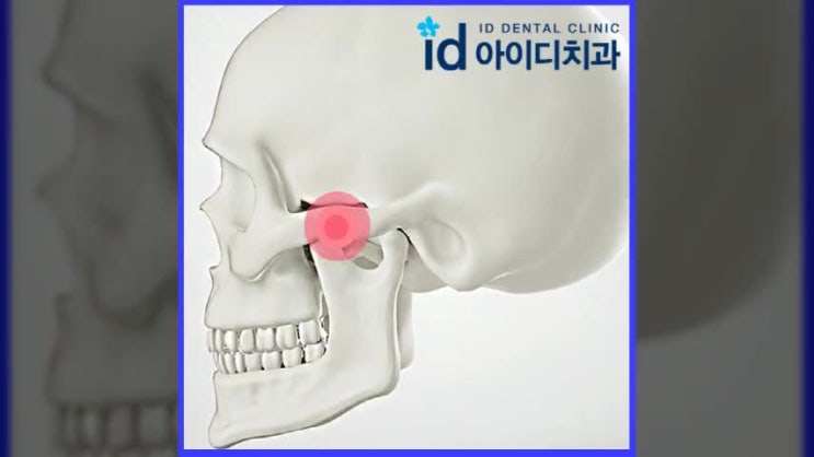  턱관절치료 비수술적인 방법 원하신다면?