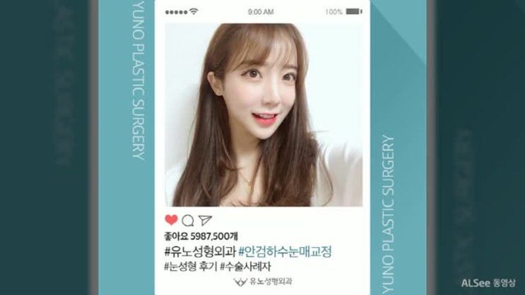 안검하수눈매교정 구하라보다 아름답게~! 
