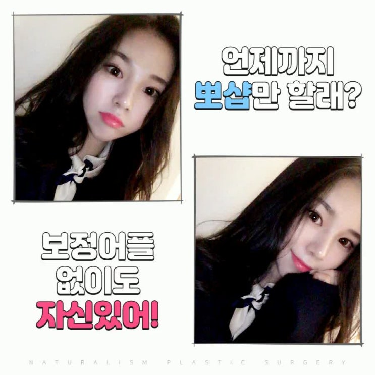  코성형외과유명한곳 이쁜미모를 얻어야죠