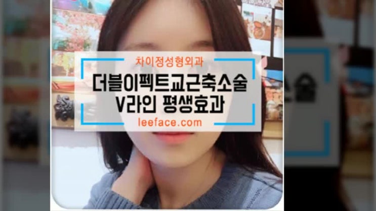  교근축소술 갸름해지는거야~~