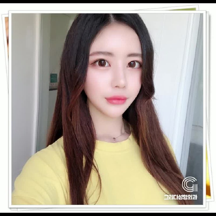  코재수술잘하는곳 현명하게 판단내리자