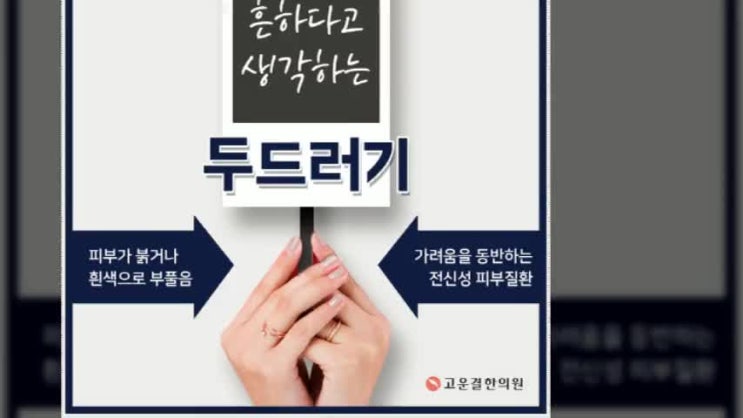  콜린성두드러기치료 너무나도 걱정이에요