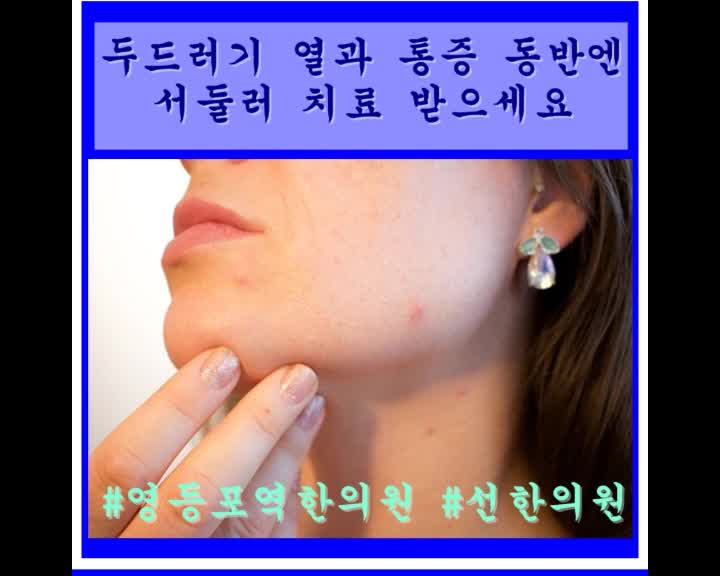  영등포 두드러기가 벌레 물린 것처럼 발현된다면 선한의원으로