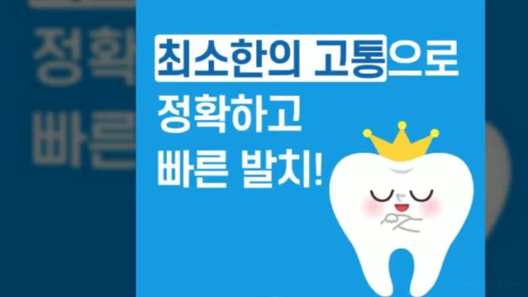 매복사랑니 발치 안심하고 믿을 수 잇는 곳 찾는다면!
