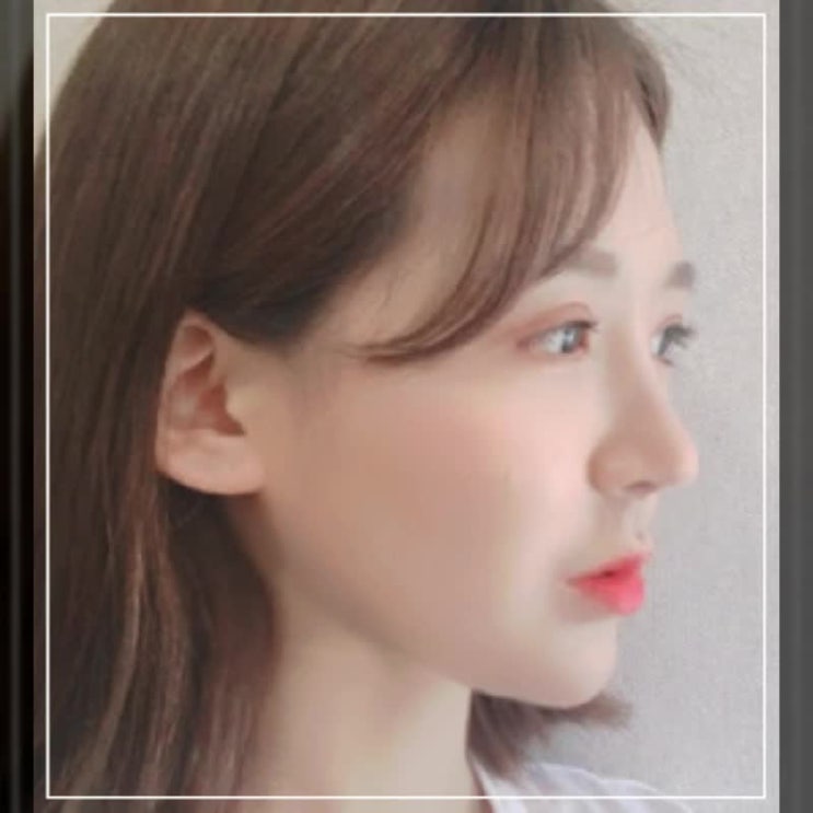  코성형유명한병원 결과적인 확률을 올리고자 한다면