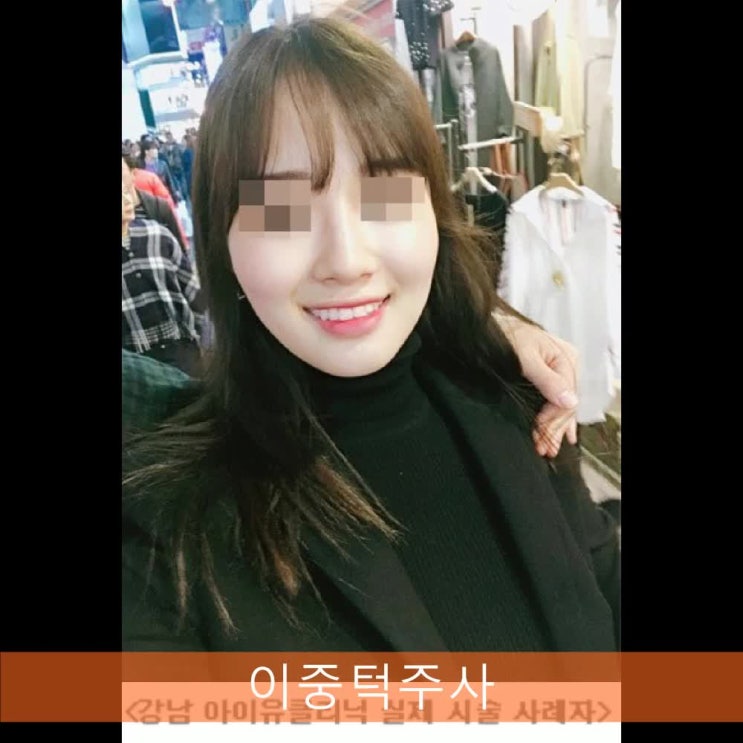  이중턱주사 몇개월동안 유지되는데요?