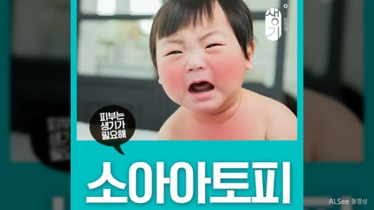  소아아토피 빨리 잡으셔야해요~!