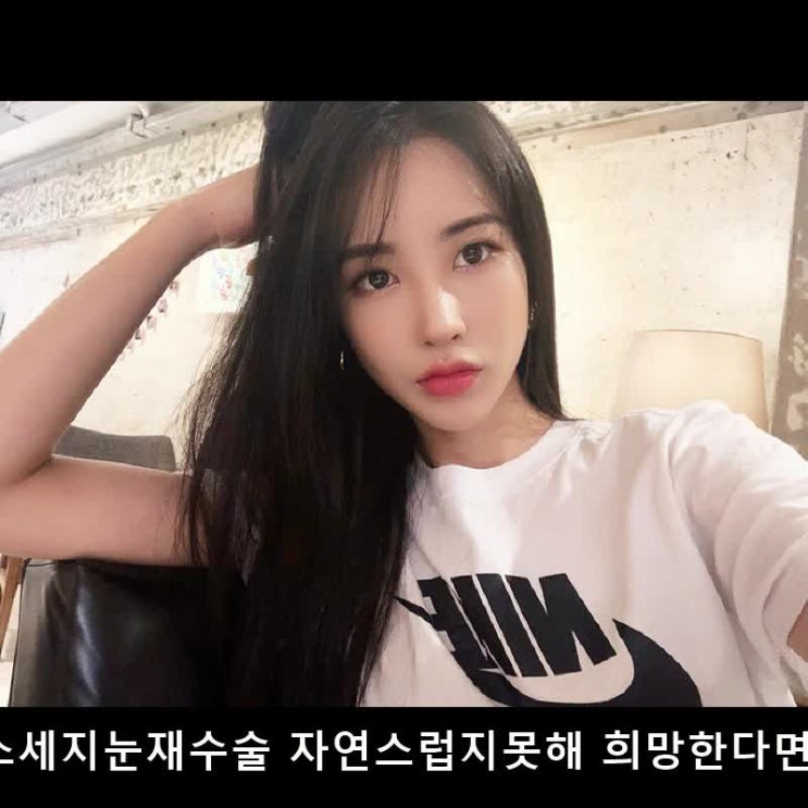  소세지눈재수술 자연스럽지못해 희망한다면?