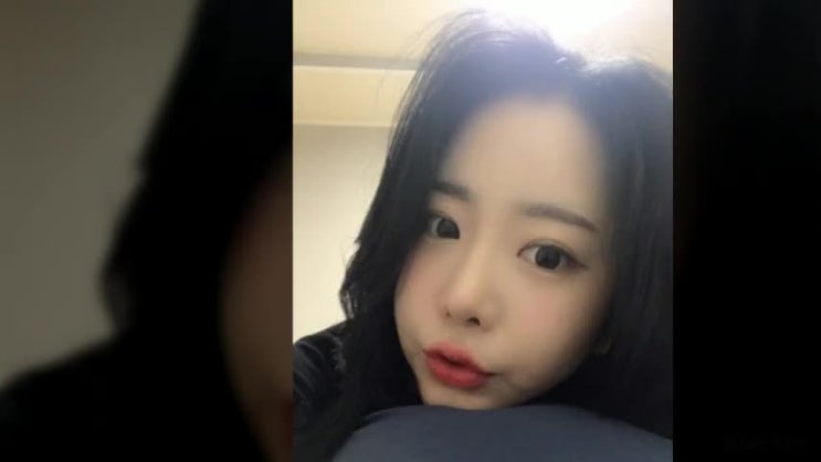  쌍꺼풀수술비용 그저 한 요소보다는