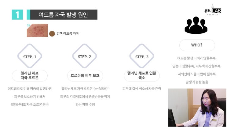  화농성여드름치료 과정이 궁금하다면