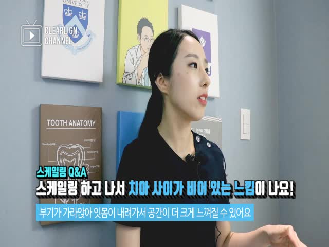  치과에서 자주 묻는 질문 - 치과위생사가 알려주는 스케일링 궁금증