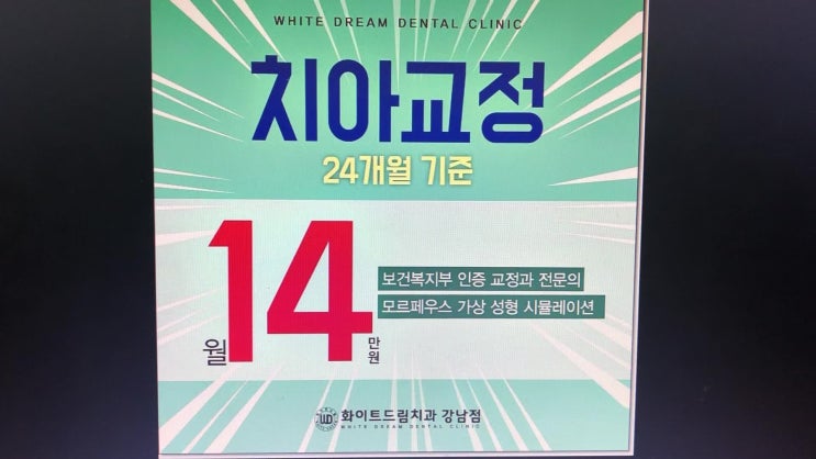  돌출입교정 발치여부는?