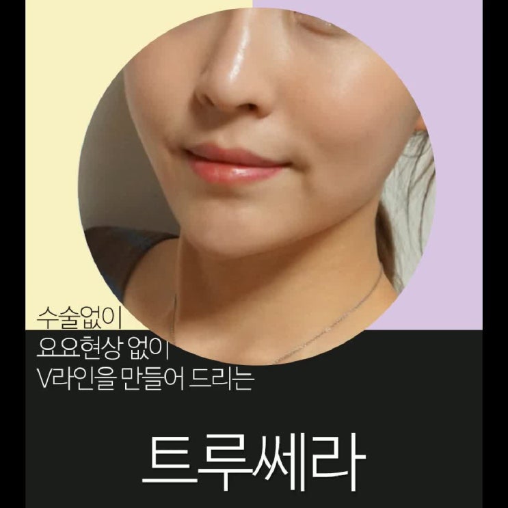  울쎄라가격 가을 타고 노화까지?