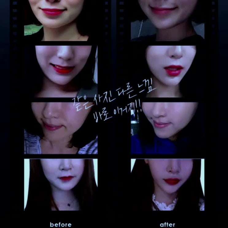  슈링크잘하는곳 이번에는 꼭!