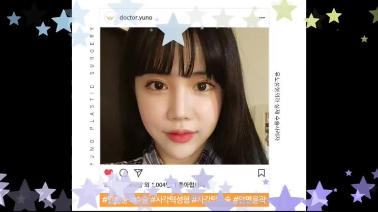  안면윤곽가격 어느 각도에서도~