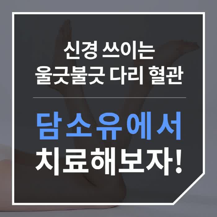 하지정맥류수술후기 언제까지 가릴거야