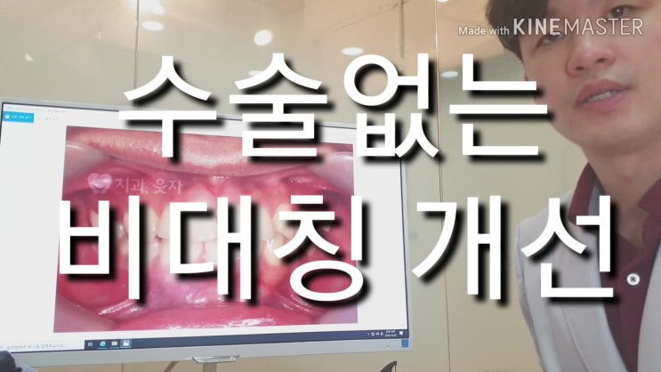  안면비대칭치아교정 충분히 수술없이도 가능합니다.