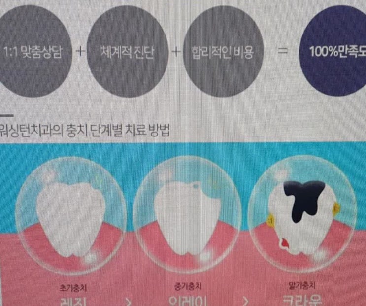  대전충치치료 체계적으로 관리해야