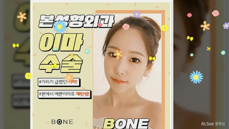  이마수술잘하는곳 여기서 새롭게 변화하자