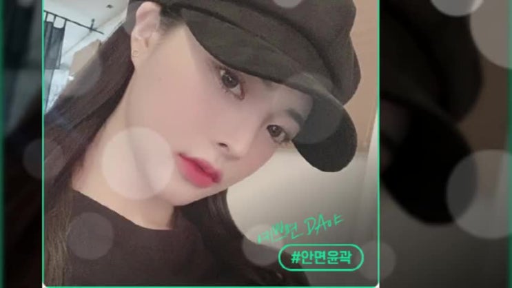  광대축소술 불유합을 조심하며