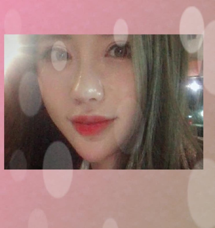  신사역쌍꺼풀재수술가격 아직 기준을 모르나요