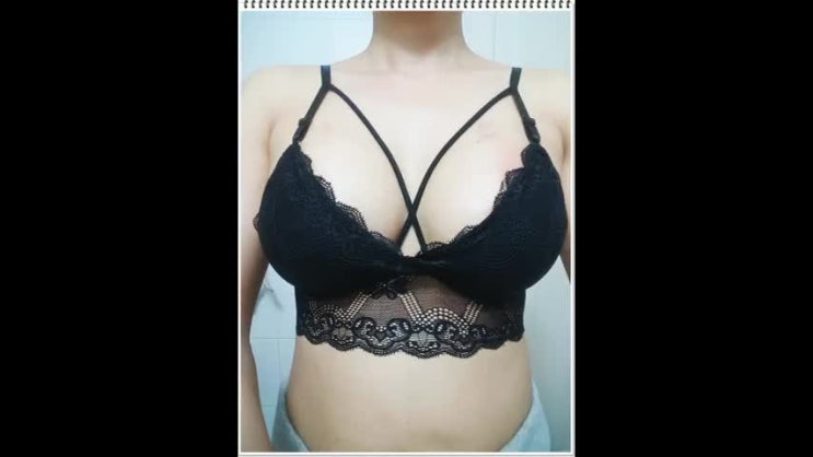  모티바가슴가슴성형후기 이제야 결정 했네요!
