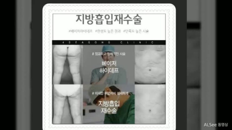  지방흡입재수술 슬림한 효과 부담없이!