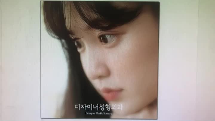  눈매교정수술전후 확연한 차이