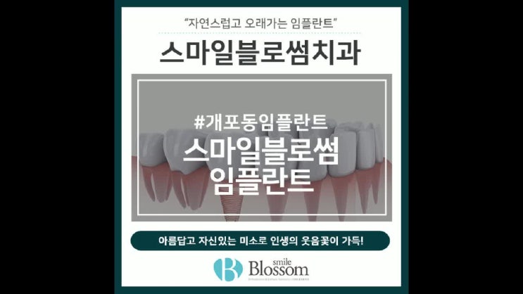  개포동임플란트 내 치아처럼 티 나지 않게
