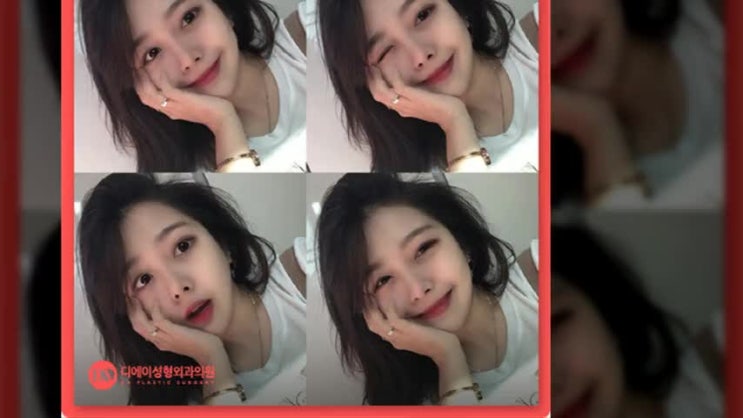  옆광대축소 균형을 유지하며
