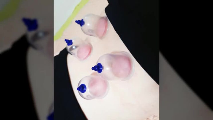  먹골역한의원 목허리통증에는? 바로유!