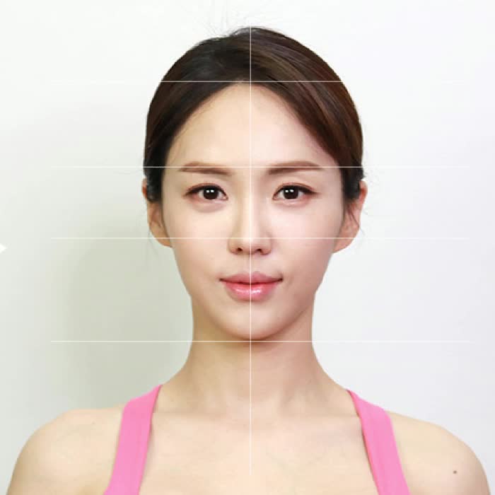  비대칭얼굴교정 신경 쓰이는 나의 얼굴형
