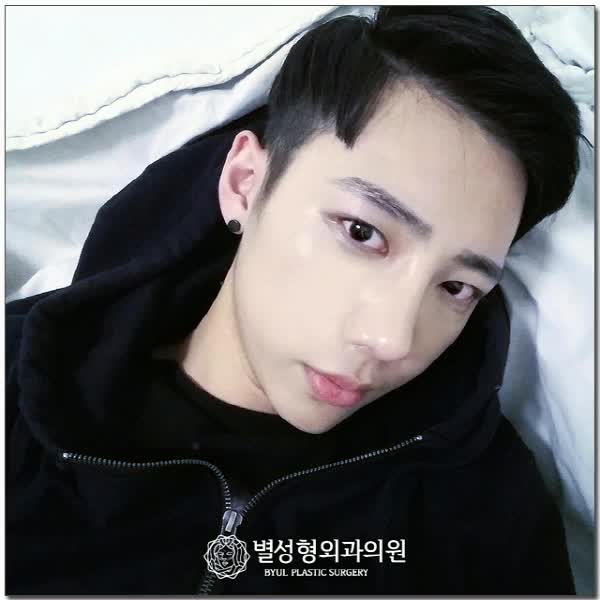  남자코성형 질환까지도