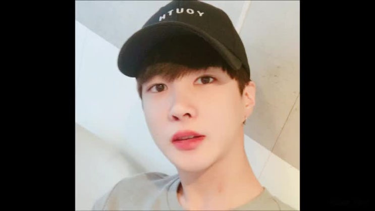  남자안면윤곽후기 아이디에서 제대로 알려줄게~