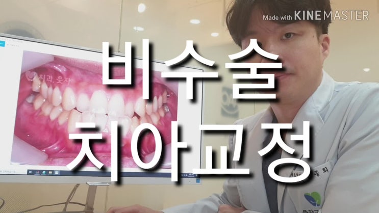  비수술치아교정 저의 원칙입니다.