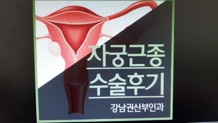  자궁근종수술후기 궁금하시다면?