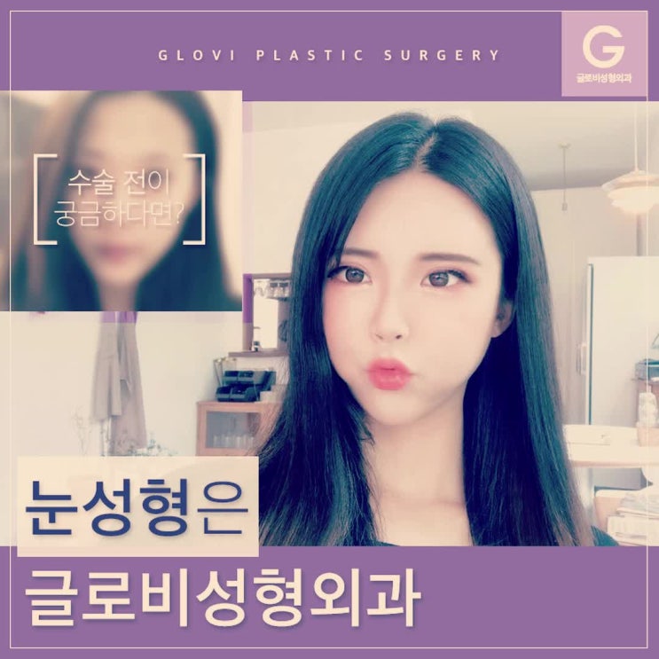  눈성형잘하는곳 개개인 맞춤으로