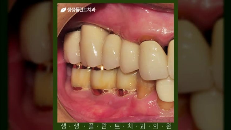  관수동치과, 기능성과 편리함을 동시에!