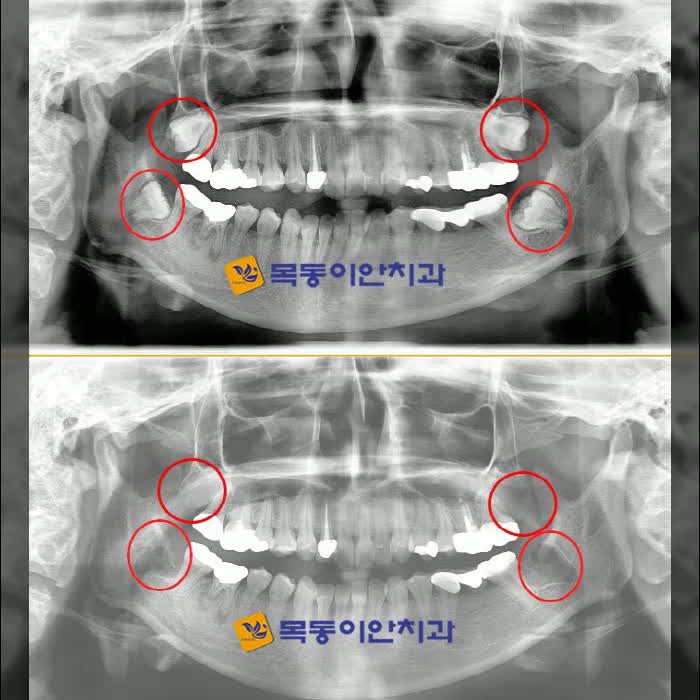  목동치과 나를 생각하는 마음으로
