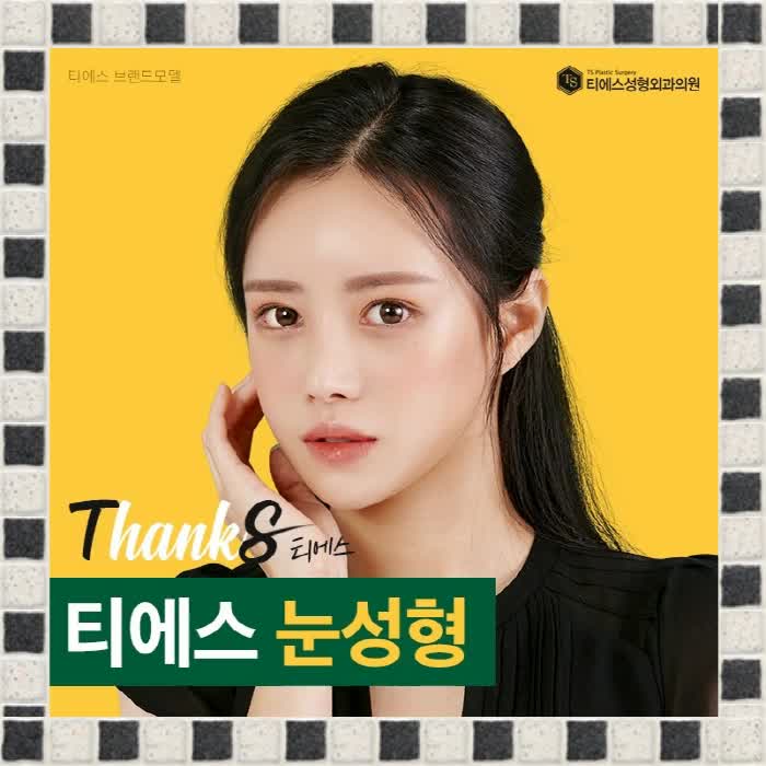  짝눈교정 으로 해맑아진 내 얼굴!!